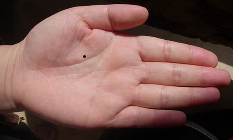 Xem bói nốt ruồi trong lòng bàn tay có ý nghĩa gì?