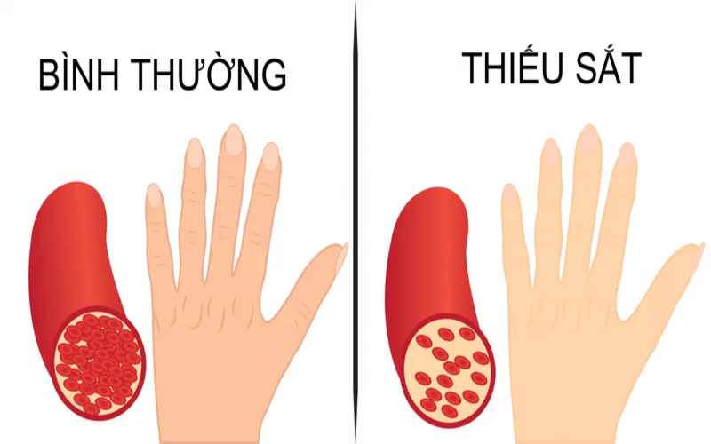 thuc pham chua nhieu sat giup bo sung nang luong va phong ngua thieu mau