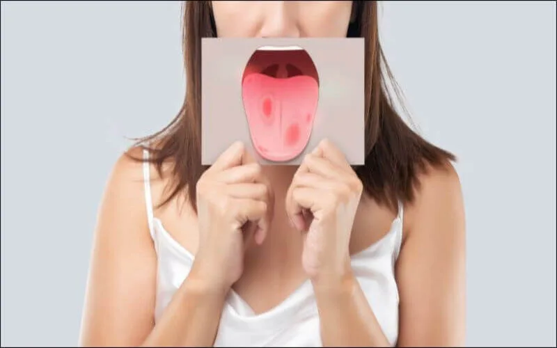 nguoi lon co bi tay chan mieng khong giai dap tu chuyen gia
